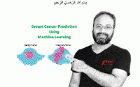 Breast Cancer Prediction